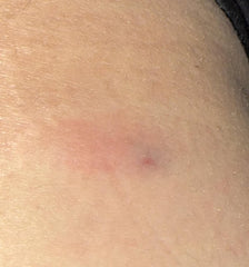 GHK-CU redness and soreness? : r/Peptides